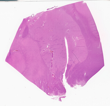 ['deident_d5b2de9d-d0b5-41d4-ab93-3c9f4b99ff4d_69d941ad.jpg']