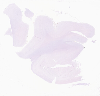['deident_4c9f1dbc-bff8-4d5c-889c-eea9e4ab504f_69d94171.jpg']