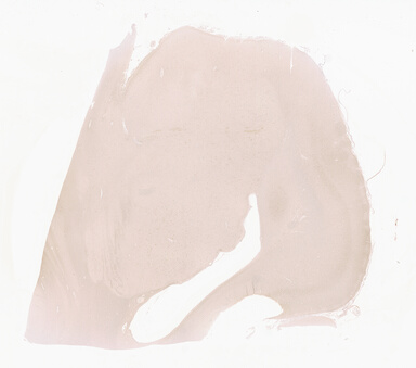['deident_26d656ee-bc40-4ac5-89fe-c28a488a5dd9_69d94165.jpg']