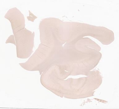 ['deident_54163d00-20e8-40d6-91ef-8cddb8fae4b0_69d94175.jpg']