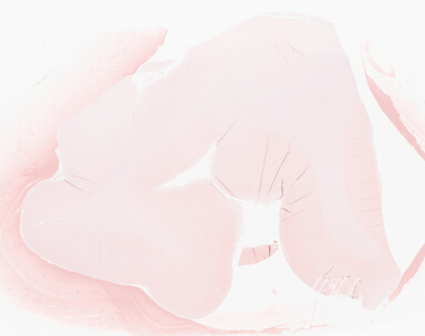 ['deident_a394afa0-a70c-45e3-88d6-6ab0dfdf502c_69d94190.jpg']