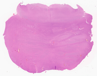 ['deident_1fc446fc-ef00-4c00-8b45-9a2fe393084c_69d94161.jpg']