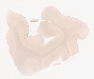 ['deident_61db2bd5-345c-4d48-804c-3a520de1c75a_69d94178.jpg']