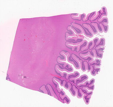 ['deident_a0c0e64e-5d63-479b-ab65-7e1ee10bfbb7_69d9418b.jpg']