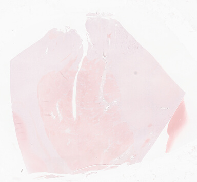 ['deident_4b3e716a-bb19-4018-821c-32570dd18b43_69d9416f.jpg']