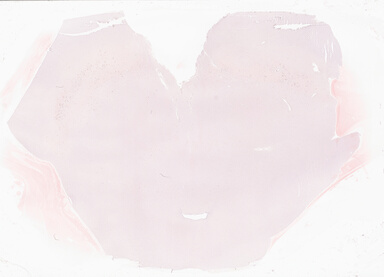 ['deident_6c21bfba-4c65-4948-9082-cc1a92e92e00_69d9417d.jpg']