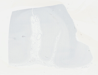 ['deident_9944d293-5a2d-4feb-b547-e3310c503502_695fce6b.jpg']