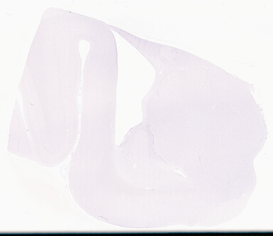 ['deident_4f1a4189-e1a5-4d26-9e1f-cb92c52afd95_695fce55.jpg']