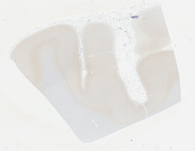 ['deident_509c8681-0da7-4164-ab39-b875cfc6c7f8_695fce57.jpg']