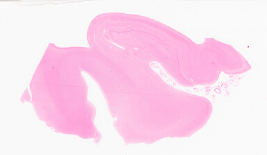 ['deident_c7130644-c3cf-4383-8412-d003f05ffe50_695fce75.jpg']