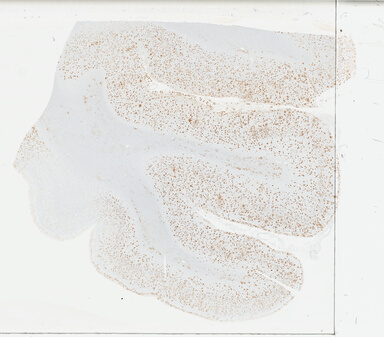 ['deident_6e7fe199-9248-4d09-be24-35d2dd508589_695fce5f.jpg']
