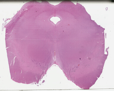 ['deident_fdd492d8-c990-49cc-92e2-78cfd5e34d58_695fce8b.jpg']