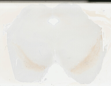 ['deident_e48471bc-daf3-492d-a460-caebd9f8f1a0_695fce82.jpg']