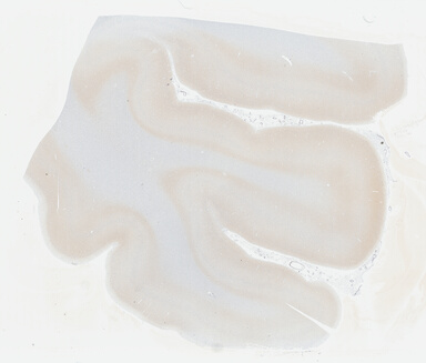 ['deident_a770dc8c-fed2-46f3-8f12-b965cd97de31_695fce71.jpg']