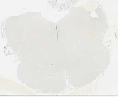['deident_cc9e4a55-0805-44b6-b4a0-17b4437a51c4_695fce78.jpg']