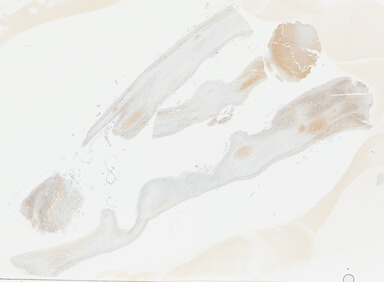 ['deident_f021aefc-fc1b-4f25-be82-cd198663808c_695fce85.jpg']