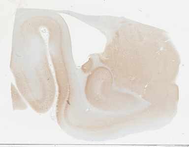 ['deident_4d1f9ed7-ee9e-45db-881c-50c98468e1f8_695fce54.jpg']