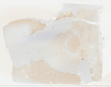 ['deident_dd169060-6cc1-469f-98fb-c3276911438e_695fce7d.jpg']