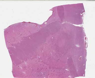 ['deident_f904fb2b-e2de-41c8-91f7-e99fbd65c408_695fce87.jpg']